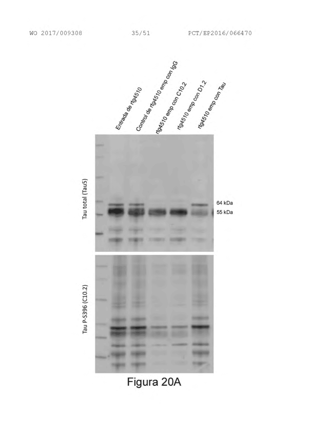 MACROCICLOS PEPTÍDICOS CONTRA ACINETOBACTER BAUMANNII.